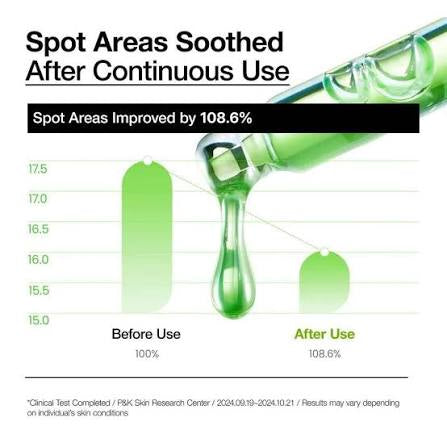 Anua Azelaic Acid 10 Hyaluron Redness Soothing Serum 30ml